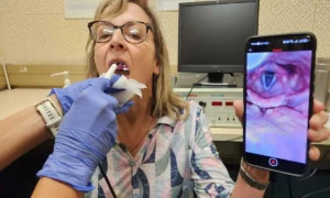 voice screening